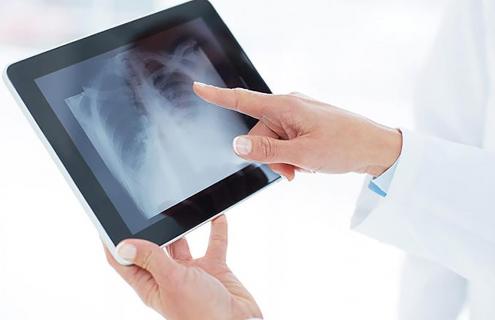 Person holding a tablet computer on which is displayed an image of a X-ray